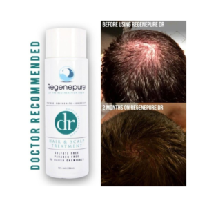 REGENEPURE DR HAIR & SCALP TREATMENT 8 OZ - FOR HAIR LOSS, HAIR REGROWTH